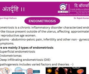 endometriosis