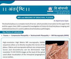 mri and imaging of brachial plexus
